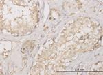 CTSD Antibody in Immunohistochemistry (Paraffin) (IHC (P))