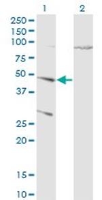 CTSD Antibody in Western Blot (WB)
