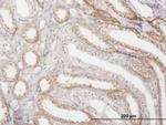 CTSK Monoclonal Antibody (2F1)