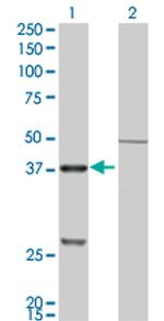 CTSK Antibody in Western Blot (WB)