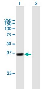 CTSL1 Polyclonal Antibody, MaxPab™