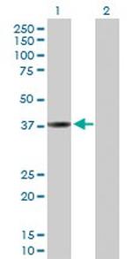 CTSL1 Polyclonal Antibody, MaxPab™