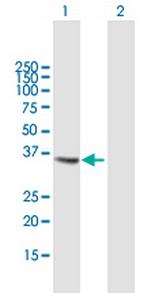 CTSS Polyclonal Antibody, MaxPab™