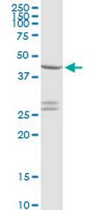 CXADR Polyclonal Antibody, MaxPab™