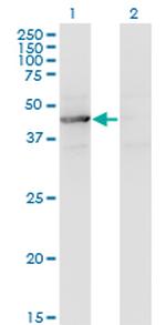 TEX28 Antibody in Western Blot (WB)