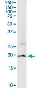 CYB5A Antibody in Immunoprecipitation (IP)