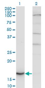CYB5A Antibody in Western Blot (WB)