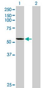 CYP2A7 Antibody in Western Blot (WB)