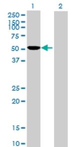 CYP2D6 Polyclonal Antibody, MaxPab™