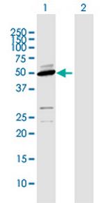 CYP2D6 Polyclonal Antibody, MaxPab™