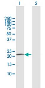 CYP4A11 Polyclonal Antibody, MaxPab™