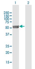 CYP11A1 Polyclonal Antibody, MaxPab™