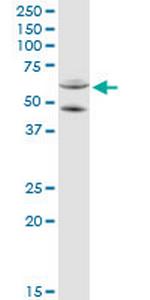 CYP11A1 Polyclonal Antibody, MaxPab™