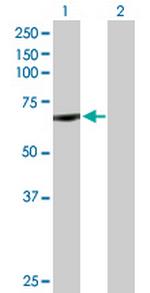 CYP11B1 Antibody in Western Blot (WB)