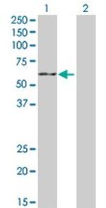 CYP19A1 Polyclonal Antibody, MaxPab™