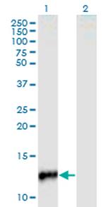 CYP24A1 Monoclonal Antibody (1E1)