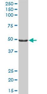 CYP27A1 Antibody in Western Blot (WB)