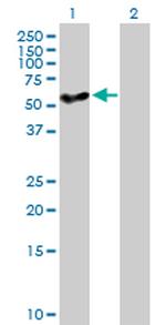 CYP27A1 Antibody in Western Blot (WB)