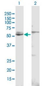 CYP51A1 Polyclonal Antibody, MaxPab™