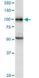 DAB2 Polyclonal Antibody, MaxPab™