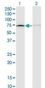 DAB2 Monoclonal Antibody (3D6)