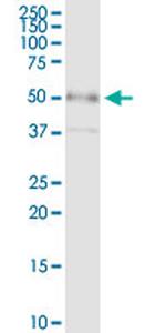 CD55 Antibody in Immunoprecipitation (IP)