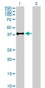 CD55 Antibody in Western Blot (WB)