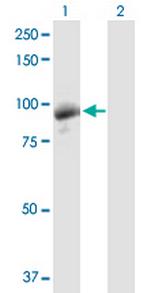 DGKG Antibody in Western Blot (WB)