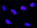 DAPK1 Monoclonal Antibody (2E7)