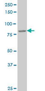 DAZ1 Monoclonal Antibody (3G10)