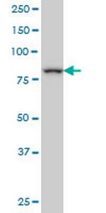 DAZ1 Monoclonal Antibody (4F3)