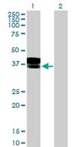 DCN Polyclonal Antibody, MaxPab™