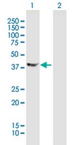 DCX Antibody in Western Blot (WB)