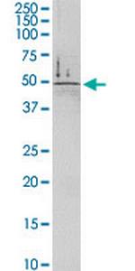 DDC Polyclonal Antibody, MaxPab™