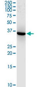 AKR1C1 Antibody in Western Blot (WB)