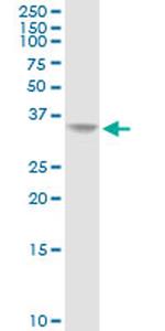AKR1C2 Antibody in Western Blot (WB)