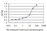 AKR1C2 Antibody in ELISA (ELISA)