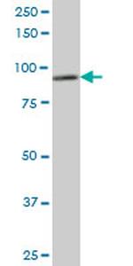 DDX1 Antibody in Western Blot (WB)