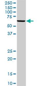 DDX6 Antibody in Western Blot (WB)