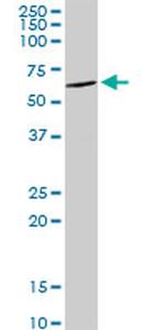 DDX6 Antibody in Western Blot (WB)