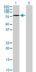 DDX6 Antibody in Western Blot (WB)