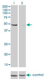 DDX6 Antibody in Western Blot (WB)