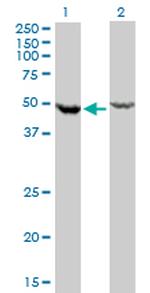 DDX6 Antibody in Western Blot (WB)
