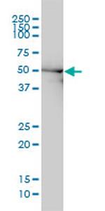 DDX6 Antibody in Western Blot (WB)