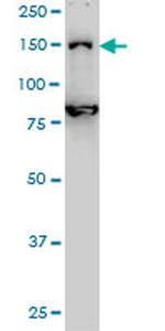 DHX8 Monoclonal Antibody (1E10)