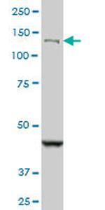 DHX8 Monoclonal Antibody (1D6)