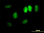 DDX11 Antibody in Immunocytochemistry (ICC/IF)