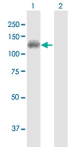 DDX11 Antibody in Western Blot (WB)