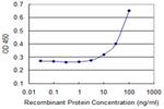 DDX11 Antibody in ELISA (ELISA)
