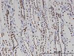 DDX11 Antibody in Immunohistochemistry (Paraffin) (IHC (P))
